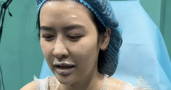 Quyên Qui tu sửa gương mặt avatar1767495308278 17674953091141939151874png