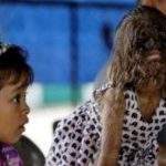 Cô bé “người sói” hiện ra sao? avatar1768380932041 17683809324561432480463jpg