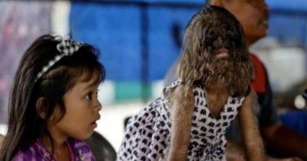 Cô bé “người sói” hiện ra sao? avatar1768380932041 17683809324561432480463jpg