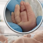 Cắt dây rốn, nữ hộ sinh vô tình cắt đứt ngón tay trẻ sơ sinh: Bé phải nối ngón, gia đình bàng hoàng avatar1768462281529 17684622821081312098667png