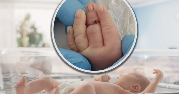Cắt dây rốn, nữ hộ sinh vô tình cắt đứt ngón tay trẻ sơ sinh: Bé phải nối ngón, gia đình bàng hoàng avatar1768462281529 17684622821081312098667png