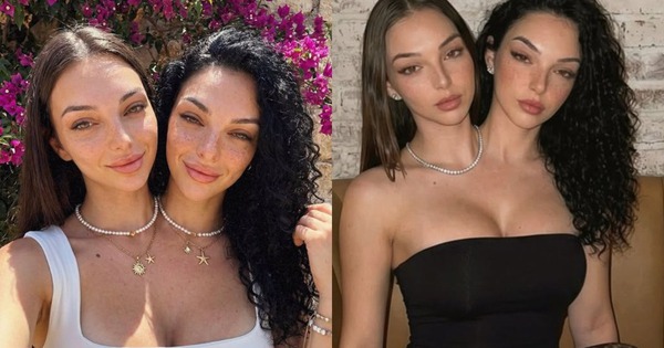 Cú lừa ngoạn mục của kỷ nguyên số: Cặp song sinh dính liền "vạn người mê" này thực chất là sản phẩm của AI avatar1769421697803 1769421698441997707077jpg