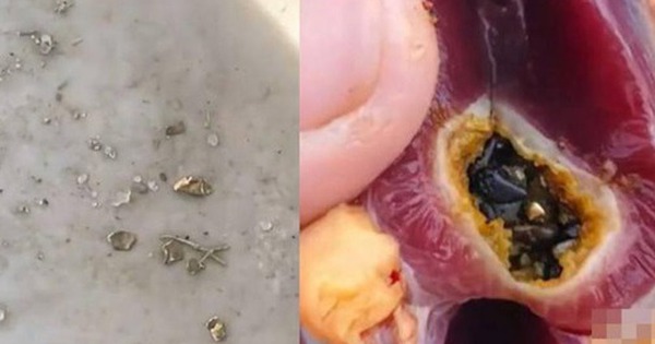 Mổ vịt ăn Tết, người đàn ông sốc nặng khi thấy vàng bên trong avatar1772360696308 17723606968671172330893 0 71 315 575 crop 17723607146031784147228jpg