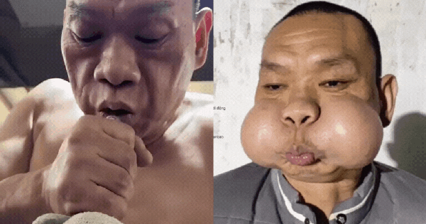 Nỗi khổ của “hoàng tử ếch” ban sao cua gia toc giau nhat the gioi 22 1766377289738135916064gifpng