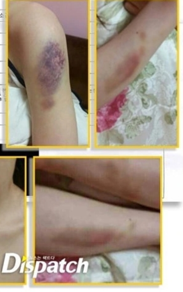 Bí mật động trời của Kim Hyun Joong (Vườn Sao Băng) sau 11 năm mới được công bố- Ảnh 2.