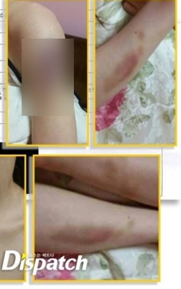 Bí mật động trời của Kim Hyun Joong (Vườn Sao Băng) sau 11 năm mới được công bố- Ảnh 3.