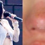 Nữ hoàng gợi cảm showbiz bị bỏng mặt, xót cho nhan sắc trời ban bm1 1770252501952944918520 0 0 351 670 crop 17702525213821579686135jpg