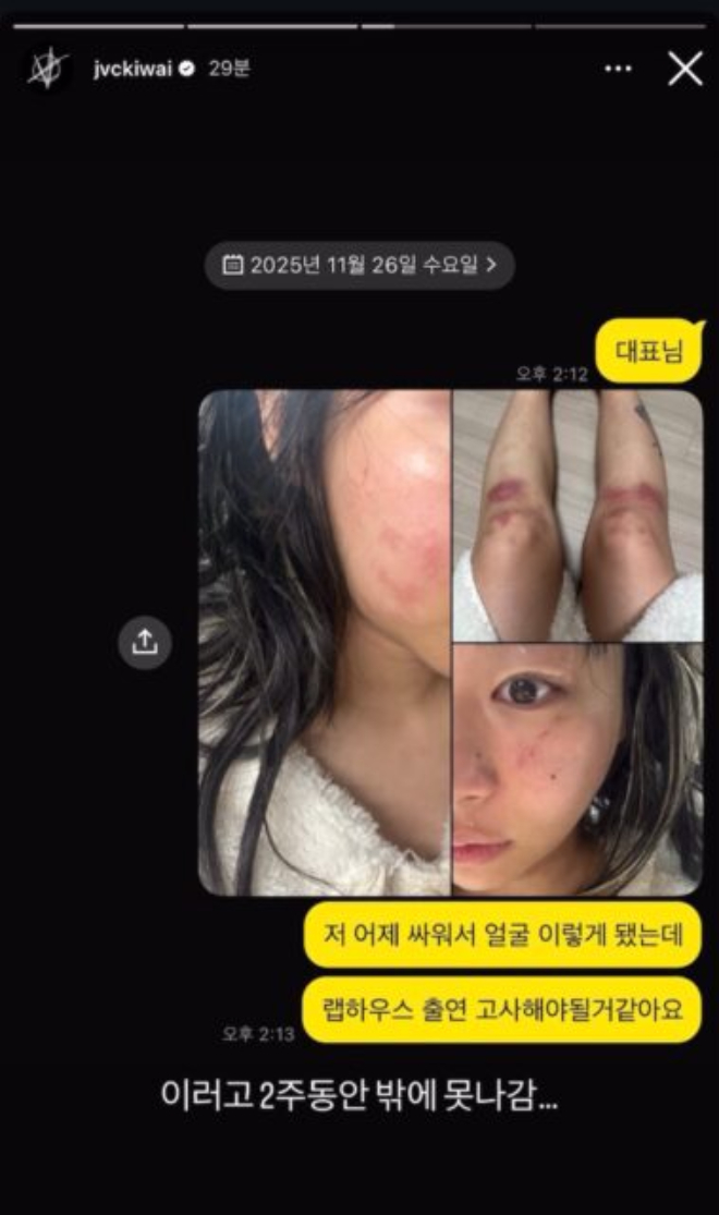 Nữ rapper 96 tung ảnh bị bạn trai đánh bầm dập đến mức hủy show, đàng trai hùng hổ phốt ngược gây phẫn nộ- Ảnh 2.