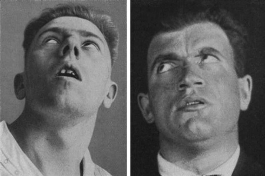 Căn bệnh kỳ lạ đã giết chết 500.000 người rồi đột ngột biến mất- Ảnh 1.