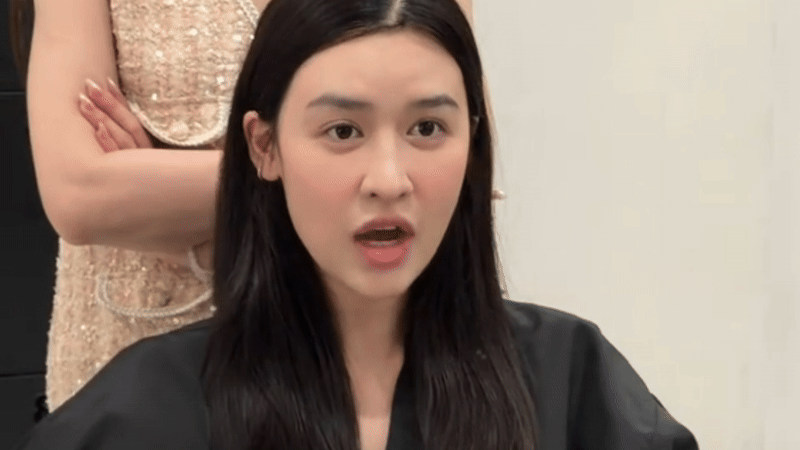 Quyên Qui tu sửa gương mặt- Ảnh 2.