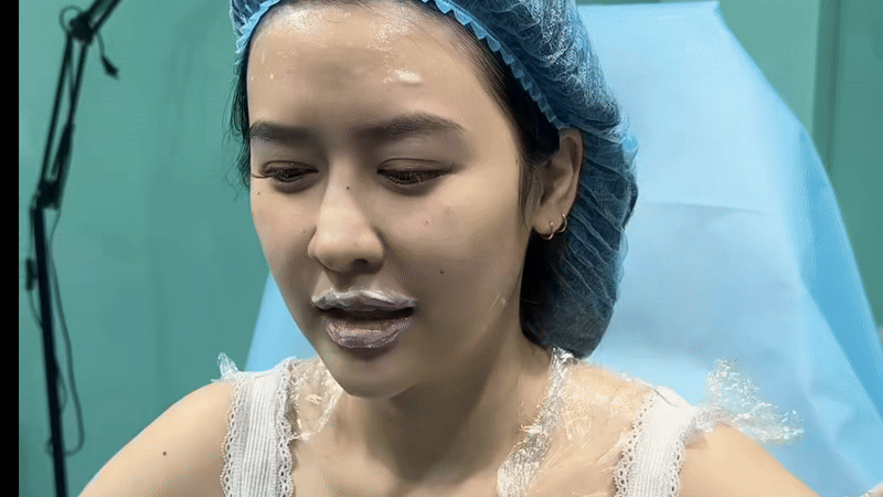 Quyên Qui tu sửa gương mặt- Ảnh 1.