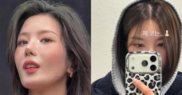 Nữ thần Waterbomb che mũi vì "dao kéo" hỏng? fotojet 1770879440885308597491 0 0 352 672 crop 17708794516992003317098jpg