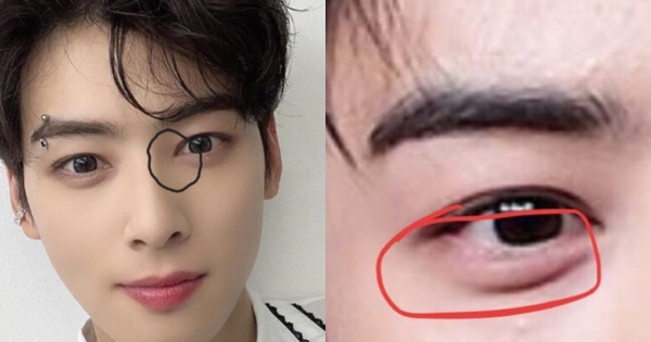 "Gương mặt thiên tài" của Cha Eun Woo là giả dối nốt? fotojet 46 1769331915927602111246 34 0 386 672 crop 17693319256771368195921jpg