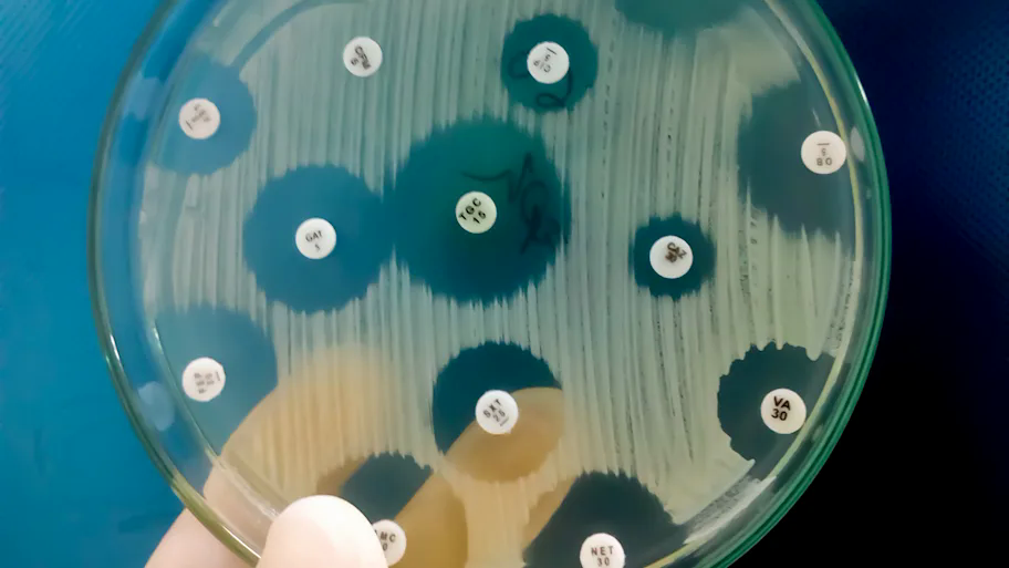 Một thứ bí ẩn bị