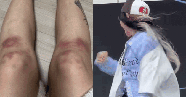 Nữ rapper 96 tung ảnh bị bạn trai đánh bầm dập đến mức hủy show, đàng trai hùng hổ phốt ngược gây phẫn nộ ju3 1765621582034788391187 0 0 352 672 crop 1765621600045225390374gifpng