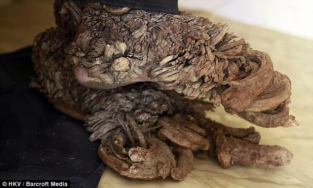 42 năm cuộc đời đầy bi kịch của người cây