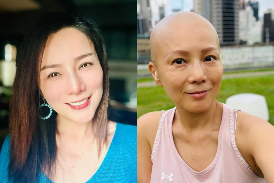 Á hậu Hong Kong suy sụp vì ung thư Á hậu Hong Kong suy sụp vì ung thư