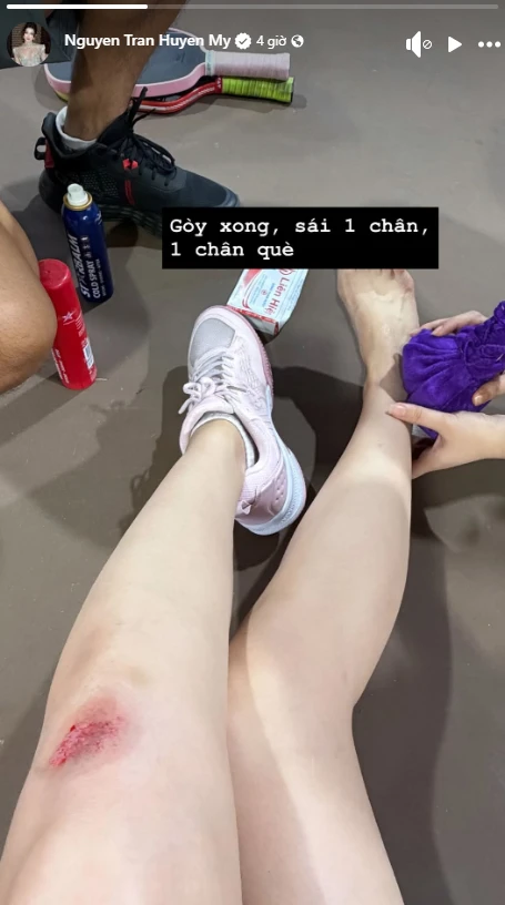 Á hậu Huyền My gặp tai nạn khi chơi pickleball Á hậu Huyền My gặp tai nạn khi chơi pickleball