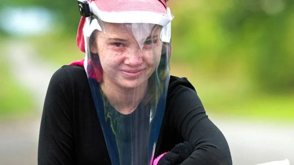 Bi kịch "cô bé ma cà rồng" đời thực