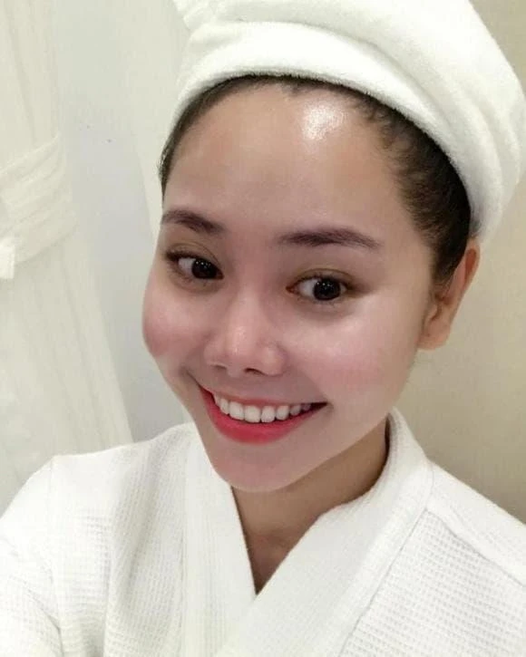 Bức ảnh chụp cận sau ca can thiệp "dao kéo" khiến mỹ nhân Việt lao đao, phải trả giá đắt Bức ảnh chụp cận sau ca can thiệp "dao kéo" khiến mỹ nhân Việt lao đao, phải trả giá đắt