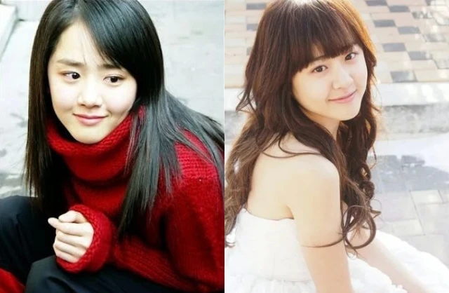 Căn bệnh khiến Moon Geun Young từ visual sáng trưng như "nàng thơ quốc dân" đến phù nề không nhận ra