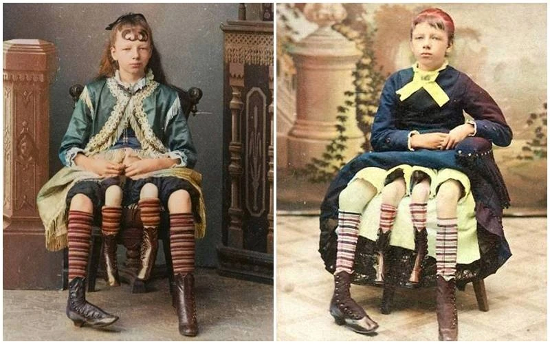 Cô gái 4 chân, 2 "vùng kín": 13 tuổi thành đại minh tinh với cuộc hôn nhân bí ẩn