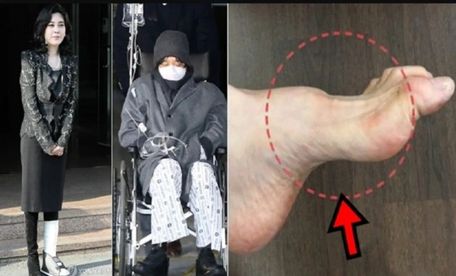 Gia tộc Samsung và căn bệnh di truyền đáng sợ mang tên teo cơ MÁC: Có tất cả nhưng cũng không thể chữa khỏi