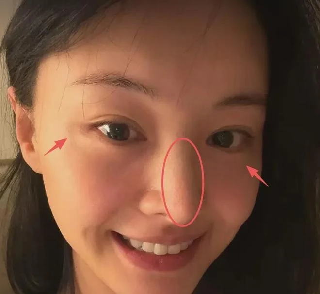 Khó tin nổi đây là Trịnh Sảng sau khi “dao kéo” toàn bộ gương mặt