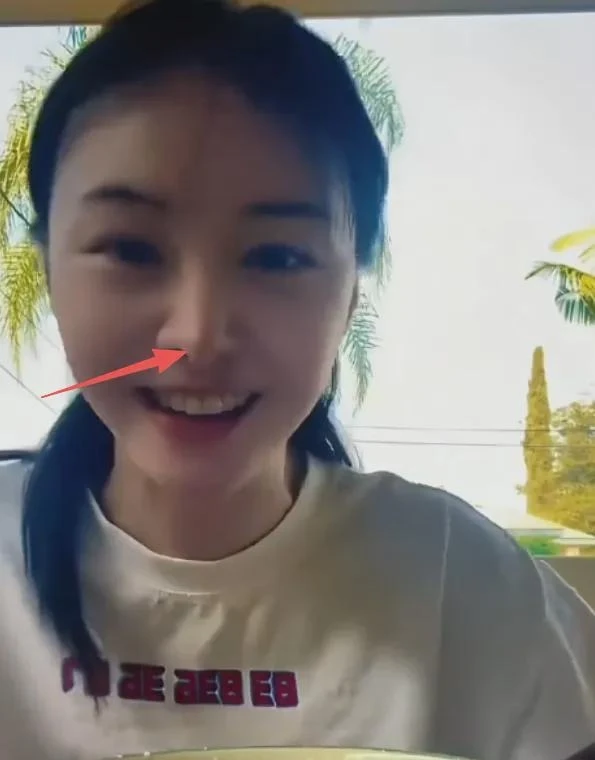 Khó tin nổi đây là Trịnh Sảng sau khi “dao kéo” toàn bộ gương mặt