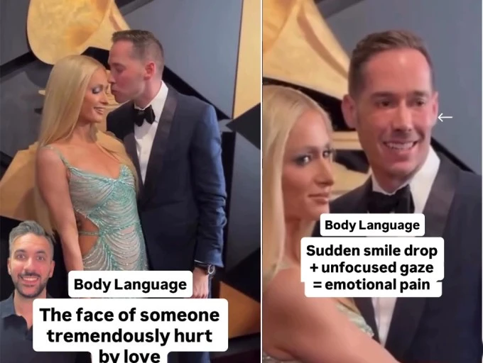 Khoảnh khắc khiến chồng Paris Hilton bị nhận xét tổn thương vì quá yêu vợ