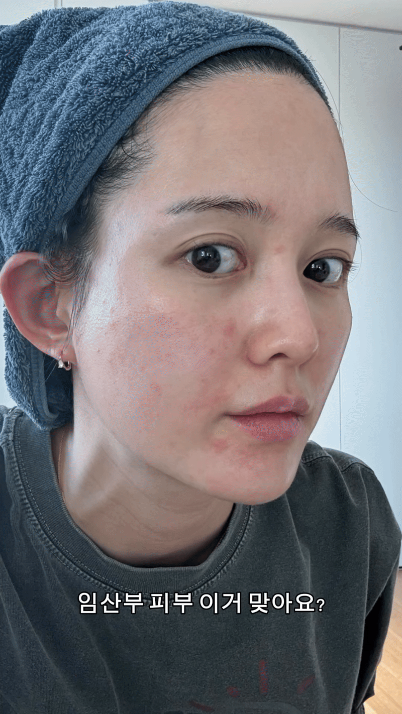 Mỹ nhân Mặt Trăng Ôm Mặt Trời nguy cơ bị ung thư ngay trước ngày cưới