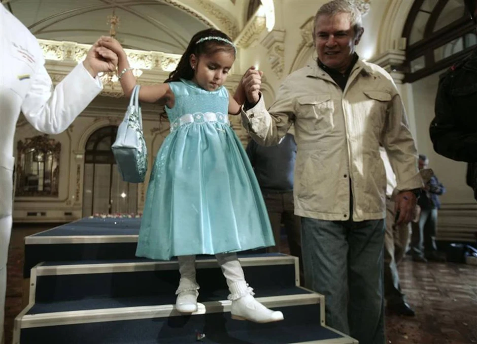 Nàng tiên cá ngoài đời thực: Bé gái chào đời với đôi chân dính liền và 15 năm sống năm phi thường như "một kỳ tích y học"