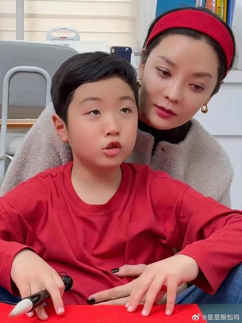 Nhan sắc gây sốc Chae Rim sau nhiều năm ở ẩn