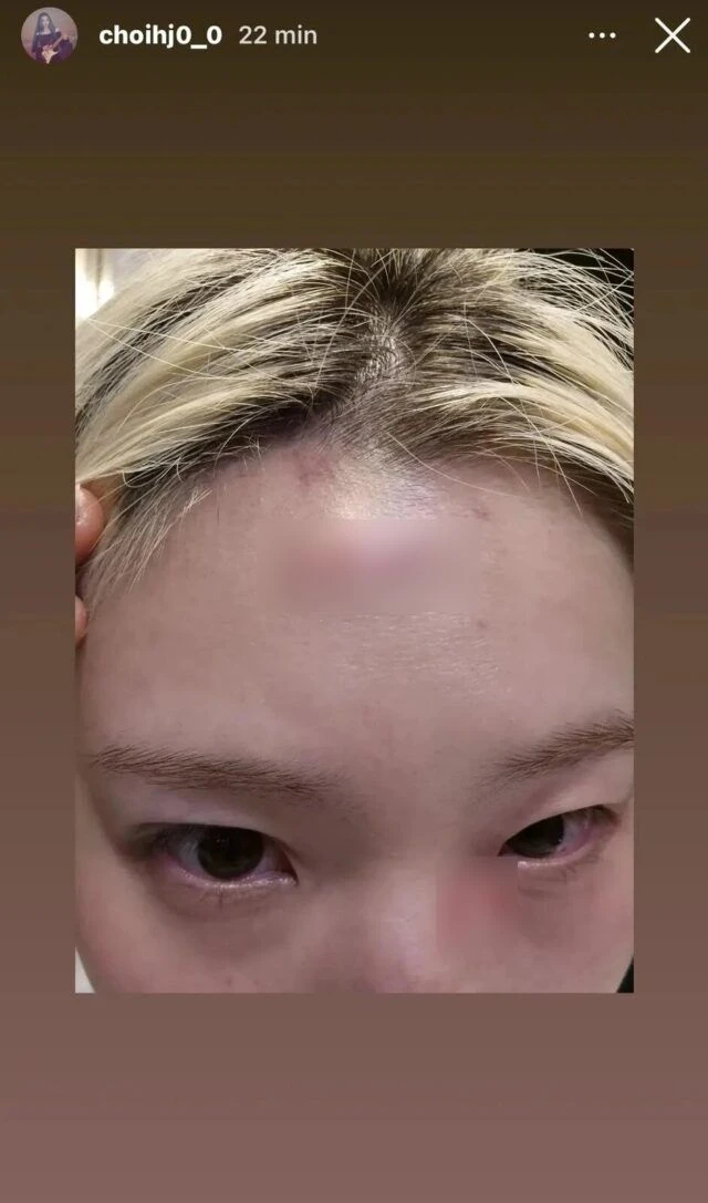 Nữ ca sĩ bị hành hung nghiêm trọng, còn bị ép viết thư xin lỗi