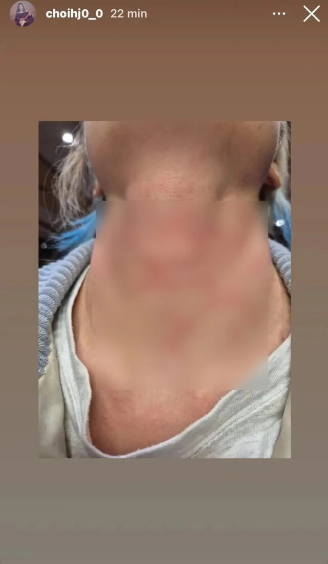 Nữ ca sĩ bị hành hung nghiêm trọng, còn bị ép viết thư xin lỗi