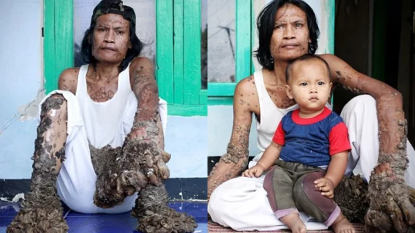 42 năm cuộc đời đầy bi kịch của người cây kenhtingame com thumb 42 nam cuoc doi day bi kich cua nguoi cay c32f1773725628540 940w