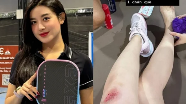 Á hậu Huyền My gặp tai nạn khi chơi pickleball kenhtingame com thumb a hau huyen my gap tai nan khi choi pickleball be611774316947429 940w