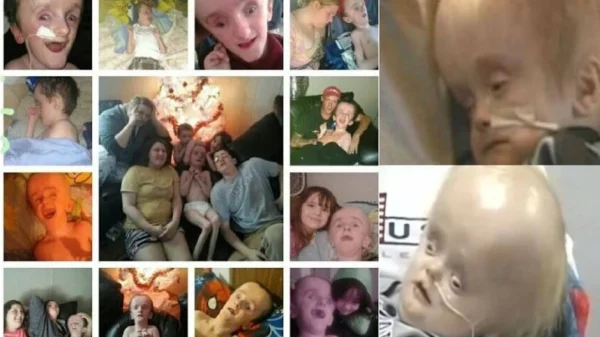 Cậu bé sinh ra không có não sống 12 năm cuộc đời thế nào? kenhtingame com thumb cau be sinh ra khong co nao song 12 nam cuoc doi the nao 34001773912369406 940w