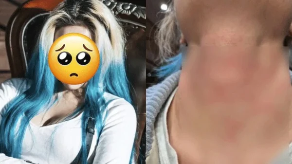 Nữ ca sĩ bị hành hung nghiêm trọng, còn bị ép viết thư xin lỗi kenhtingame com thumb nu ca si bi hanh hung nghiem trong con bi ep viet thu xin loi 42001774099011896 940w