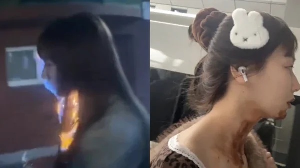 Nữ diễn viên bị bỏng mặt nghiêm trọng trong ngày sinh nhật 27 tuổi do theo trend bánh kem phun lửa kenhtingame com thumb nu dien vien bi bong mat nghiem trong trong ngay sinh nhat 27 tuoi do theo trend banh kem phun lua 005d1773295911094 940w