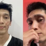 Tronie Ngô bị mặt mũi bầm dập sau khi xin vợ chơi pickleball kenhtingame com thumb tronie ngo bi mat mui bam dap sau khi xin vo choi pickleball 61d51773232718426 940w