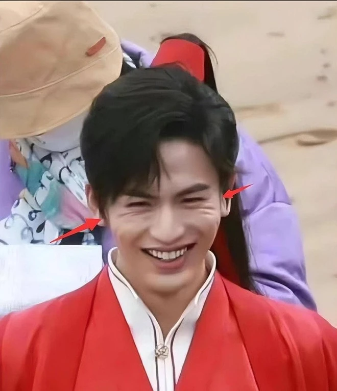 Trương Lăng Hách ảo tưởng tự nhận mình đẹp quá cũng là cái tội