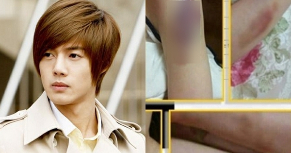 Bí mật động trời của Kim Hyun Joong (Vườn Sao Băng) sau 11 năm mới được công bố kim 011 1 17722715580028123830 4 0 356 672 crop 17722715757211999801979jpg