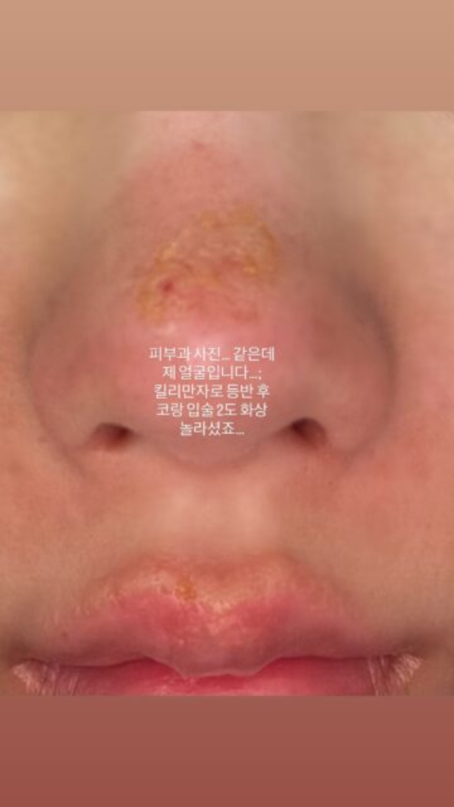 Nữ hoàng gợi cảm showbiz bị bỏng mặt, xót cho nhan sắc trời ban- Ảnh 2.