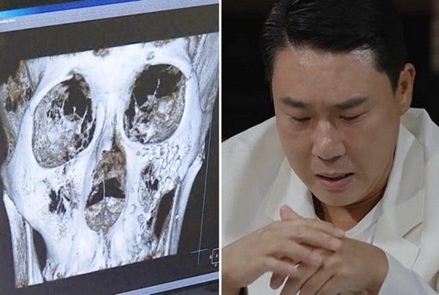 “Anh sếp showbiz” và 2 ca sĩ ẩu đả kinh hoàng trong quán nhậu, vì tiếc chiếc đồng hồ đắt tiền mà bị đấm túi bụi vào mặt- Ảnh 2.