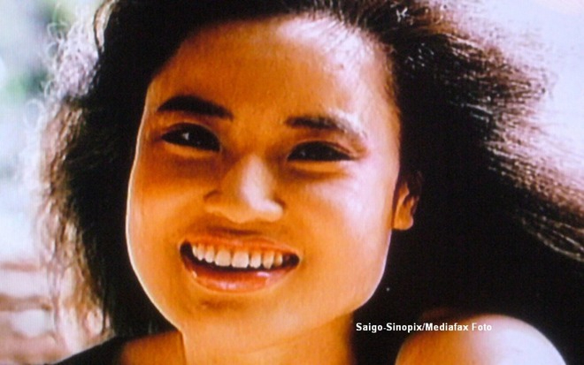 "Thảm họa thẩm mỹ" cuồng loạn tự tiêm dầu ăn vào mặt, từ mỹ nhân xinh đẹp cuối đời ra đi trong đau đớn photo 5 1666499559237152130803 163606 1766993525028 1766993526361423570065