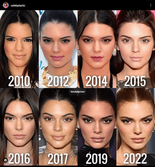 Kendall Jenner mà đẹp tự nhiên sao?- Ảnh 3.