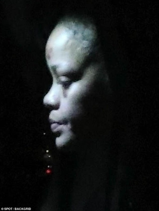 Đau giùm Rihanna- Ảnh 4.