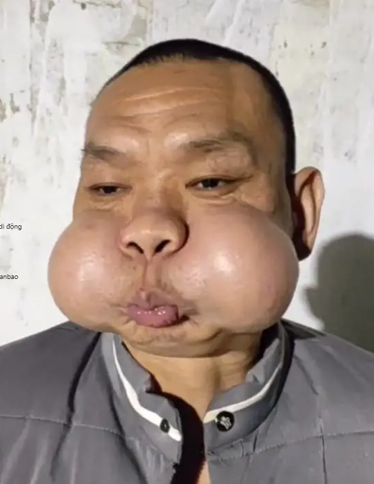 Nỗi khổ của “hoàng tử ếch”- Ảnh 1.