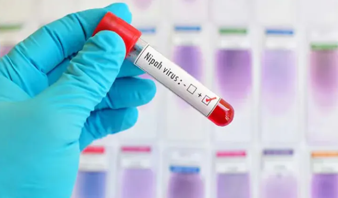Không có vaccine, tỉ lệ tử vong tới 75%, có thể không triệu chứng: Bác sĩ giải thích vì sao dịch virus Nipah cần phòng tránh ngay từ đầu?- Ảnh 3.